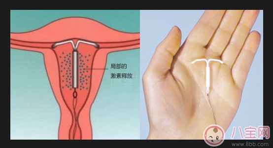 上环后什么时候可进行性生活 女性上环的最佳时期 上环后什么时候可进行性生活 女性上环的最佳时期